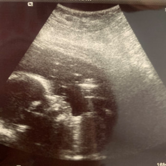 Babylist Registry Photo.