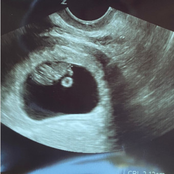 Babylist Registry Photo.