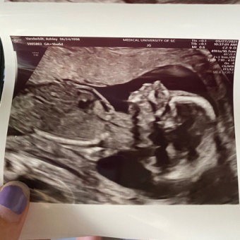 Babylist Registry Photo.
