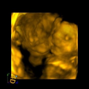 Babylist Registry Photo.