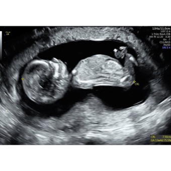 Babylist Registry Photo.