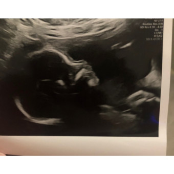 Babylist Registry Photo.