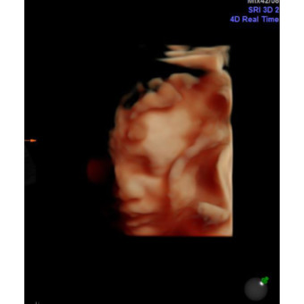 Babylist Registry Photo.