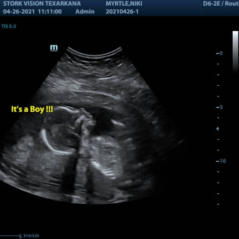 Babylist Registry Photo.