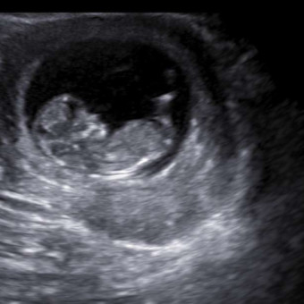 Babylist Registry Photo.