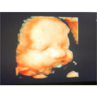 Babylist Registry Photo.