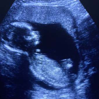 Babylist Registry Photo.