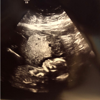 Babylist Registry Photo.