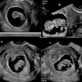 Babylist Registry Photo.