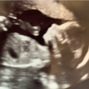 Babylist Registry Photo.