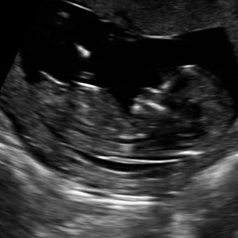 Babylist Registry Photo.