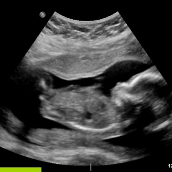 Babylist Registry Photo.