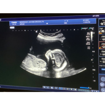 Babylist Registry Photo.