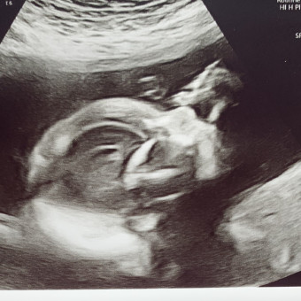 Babylist Registry Photo.