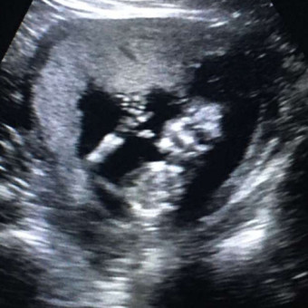 Babylist Registry Photo.