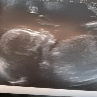 Babylist Registry Photo.