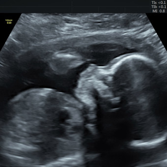 Babylist Registry Photo.