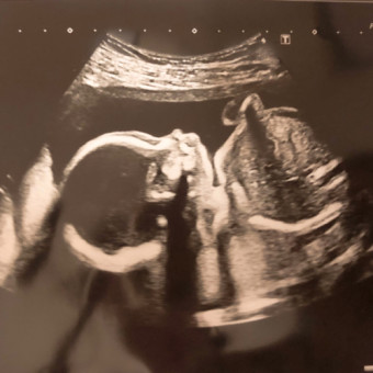 Babylist Registry Photo.