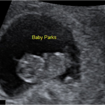 Babylist Registry Photo.