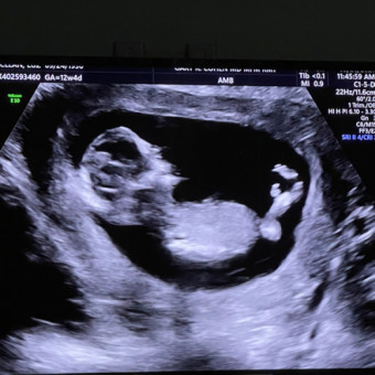Babylist Registry Photo.