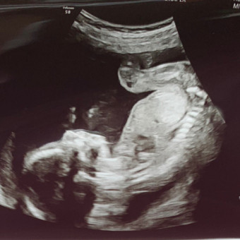 Babylist Registry Photo.