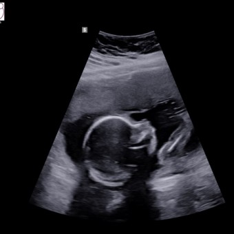 Babylist Registry Photo.