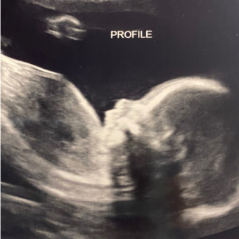 Babylist Registry Photo.