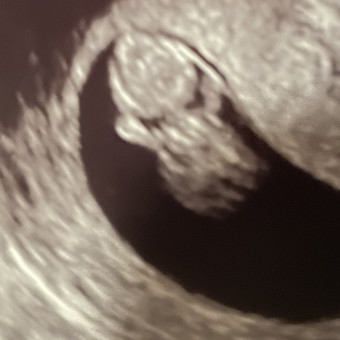 Babylist Registry Photo.