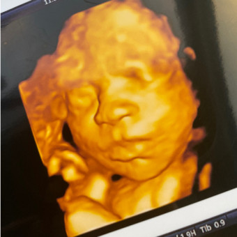 Babylist Registry Photo.