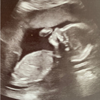 Babylist Registry Photo.