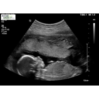 Babylist Registry Photo.
