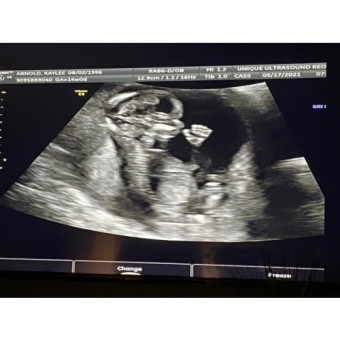 Babylist Registry Photo.