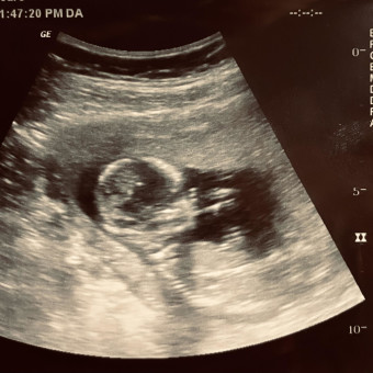 Babylist Registry Photo.