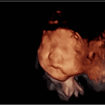 Babylist Registry Photo.