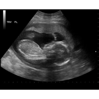 Babylist Registry Photo.