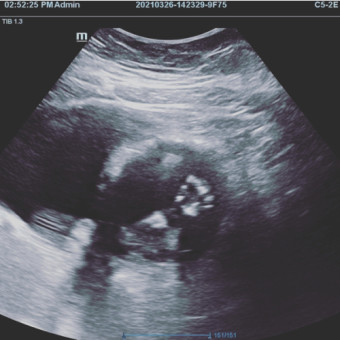 Babylist Registry Photo.