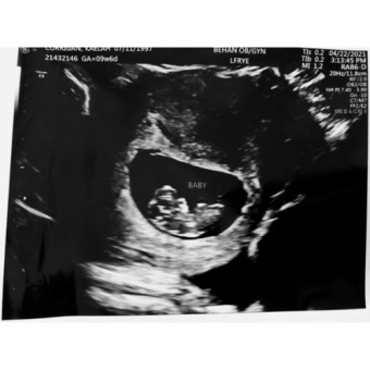 Babylist Registry Photo.