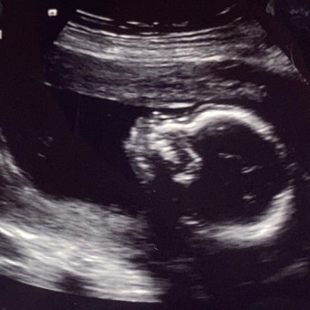 Babylist Registry Photo.