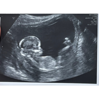 Babylist Registry Photo.