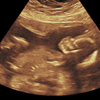 Babylist Registry Photo.