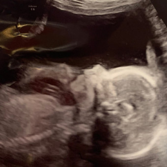 Babylist Registry Photo.