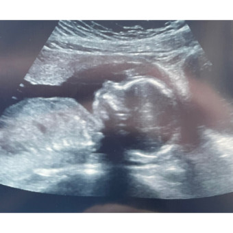 Babylist Registry Photo.