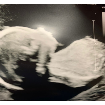 Babylist Registry Photo.
