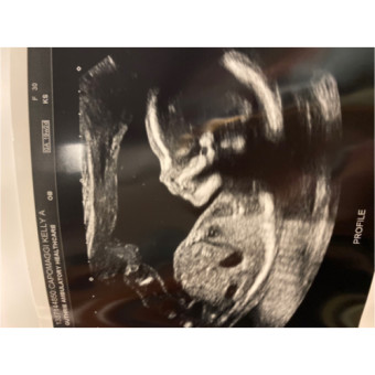 Babylist Registry Photo.