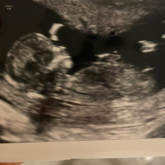 Babylist Registry Photo.