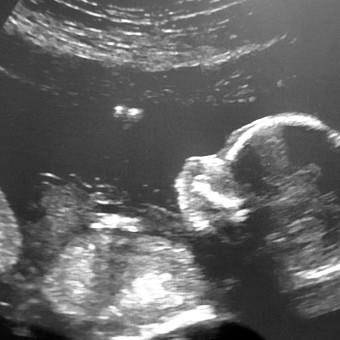 Babylist Registry Photo.
