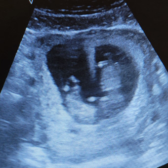 Babylist Registry Photo.