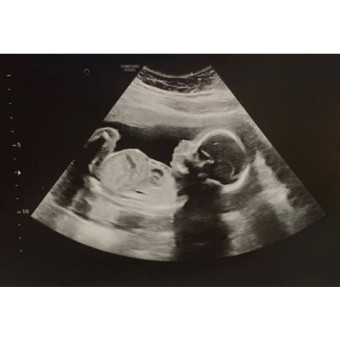 Babylist Registry Photo.
