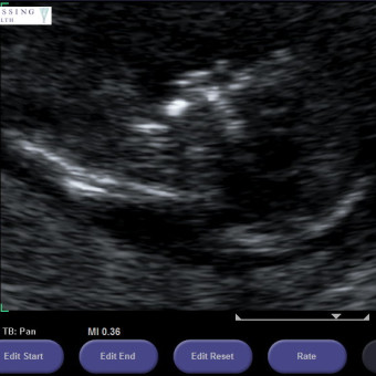 Babylist Registry Photo.