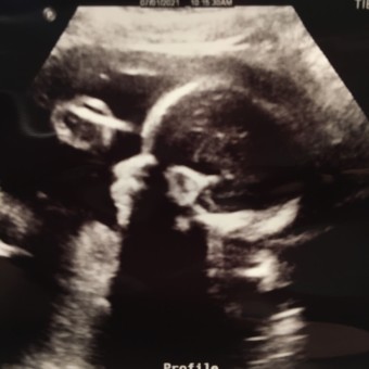 Babylist Registry Photo.